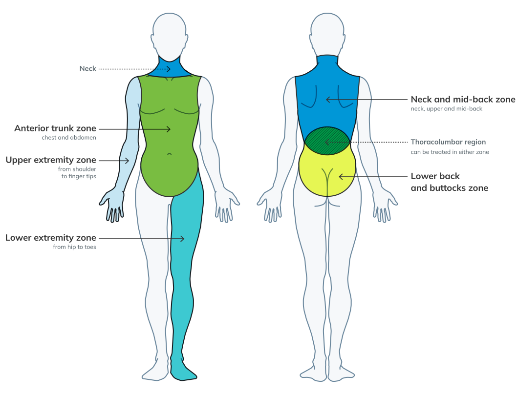 An illustration of two human bodies, one facing forward and the other backward, outlining the five main zones: anterior trunk zone, upper extremity zone, lower extremity zone, neck and mid-back zone, and lower back and buttocks zone.