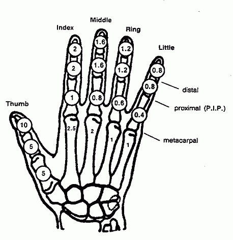 Skeletal image of the right hand with disability ratings of respective bones