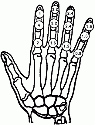 skeletal image of the right hand with disability rating of respective bones